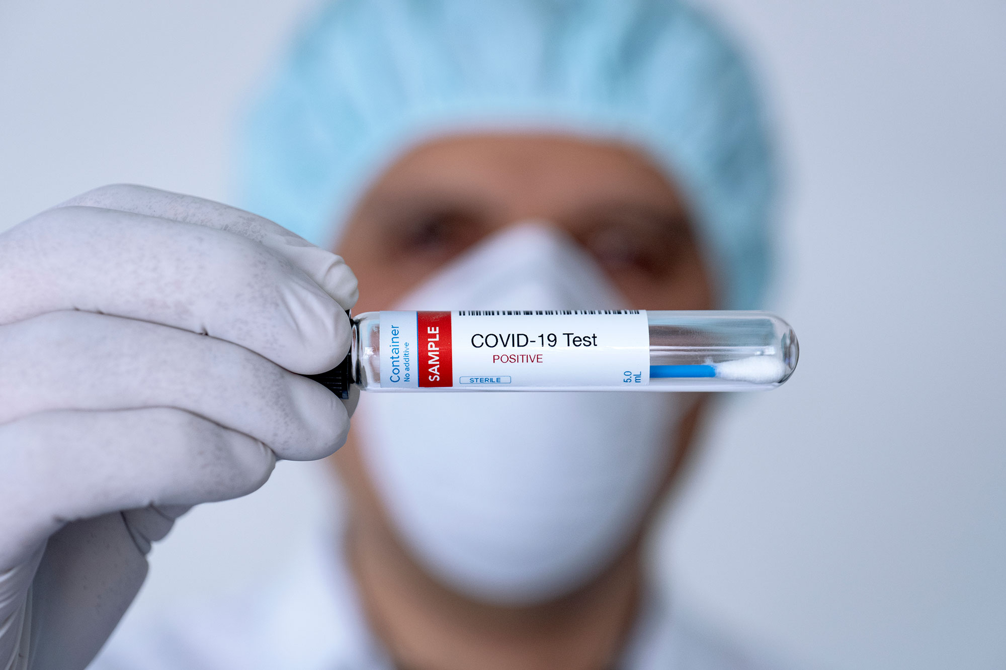 Arzt hält positiven Corona-Test in Reagenzglas
